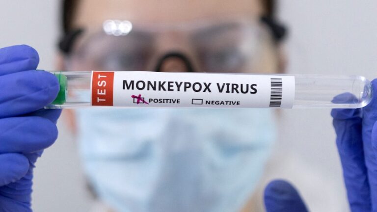 A person in medical glasses holds up a test tube with the words "monkeypox virus" on it.